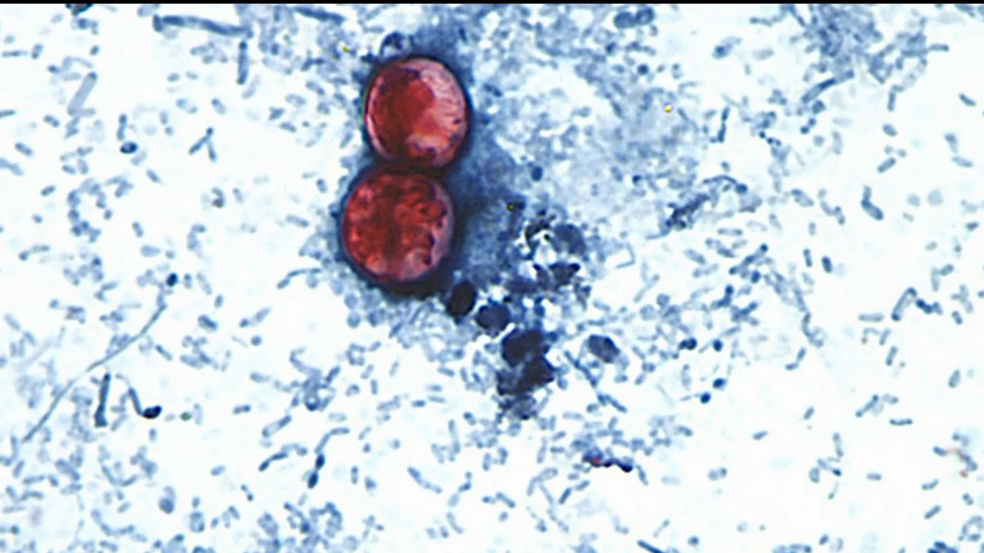 Estados Unidos cierra su mayor brote de ciclospora: casi 13 mil personas enfermaron